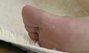 Soles of the feet Nahoko 18